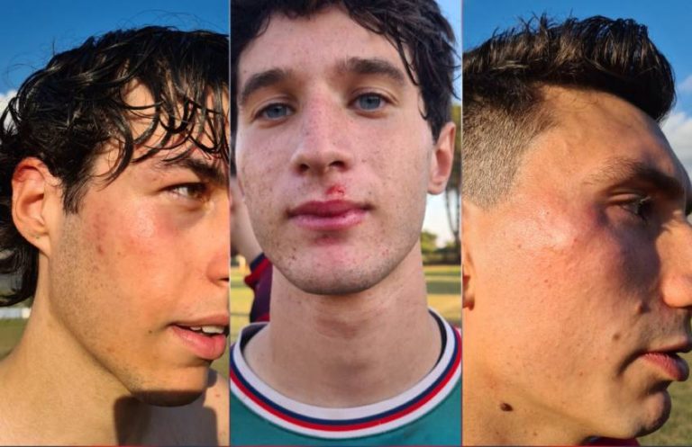 Rissa dopo Doganella – La Setina Juniores: mano pesante del giudice sportivo. Dieci ragazzi squalificati